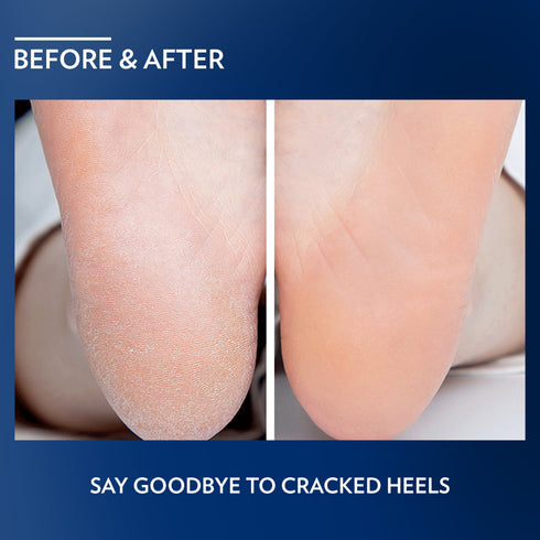 Vaseline Deep Moisture Foot Cream 55g